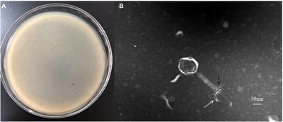 Characterization and Genomic Analysis of a Novel <mark class="highlighted">Jumbo</mark> Bacteriophage vB_StaM_SA1 Infecting Staphylococcus aureus With Two Lysins